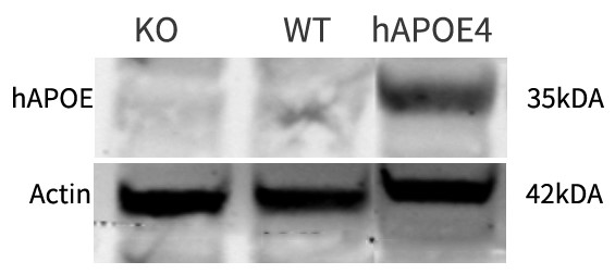 APOE4 Humanized Immune Checkpoint Mouse Model