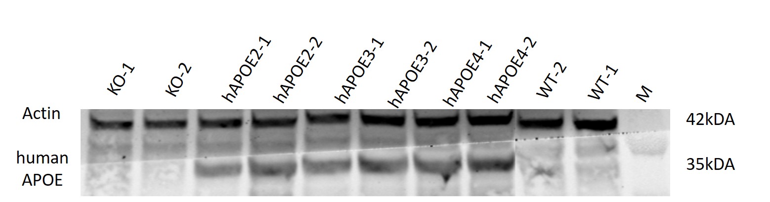 APOE3 Humanized Immune Checkpoint Mouse Model