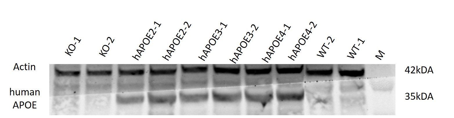 APOE4 Humanized Immune Checkpoint Mouse Model