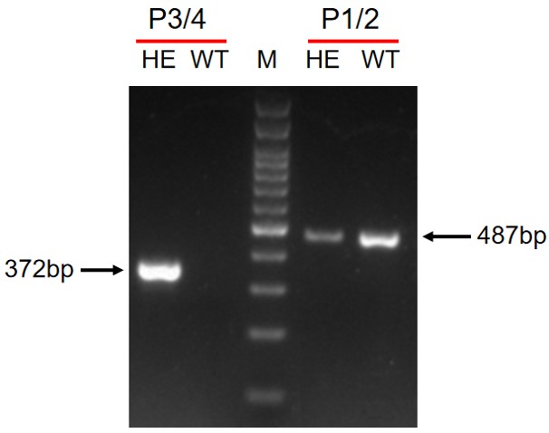 IL4RA Humanized Immune Checkpoint Mouse Model