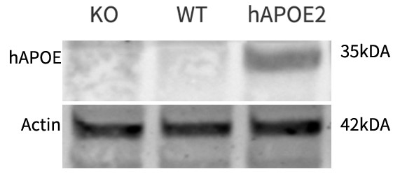 APOE2 Humanized Immune Checkpoint Mouse Model
