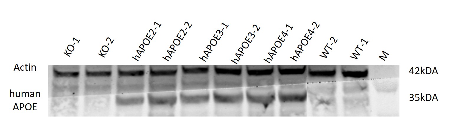 APOE2 Humanized Immune Checkpoint Mouse Model